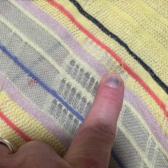 Anthropologie Yellow Striped Dress - Picture 12 of 13